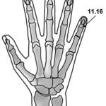 11.16 ברך אש Huǒ Xī 火膝