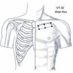 VT.02 שנים עשר הקופים Shí'èr hóu 十二猴