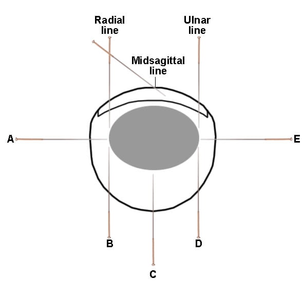 זויות דיקור איזור 11