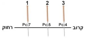 שלוש מחטים ברצף DAO MA