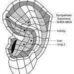 פרוטוקול NADA