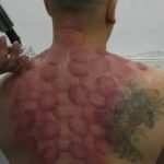 כוסות רוח שריר הטרפז קורס תיאורית הערוצים