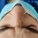 ריניטיס עם רגישות לקור