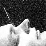 זמן השארת המחטים בטיפול דיקור באקופונקטורה של מאסטר דונג